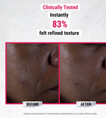 Cargar imagen en el visor de la galería, KIEHLS ULTRA PURE HIGH-POTENCY SERUM 9.8% GLYCOLIC ACID