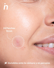 NIPSKIN INVISIBLE PIMPLE PATCHES