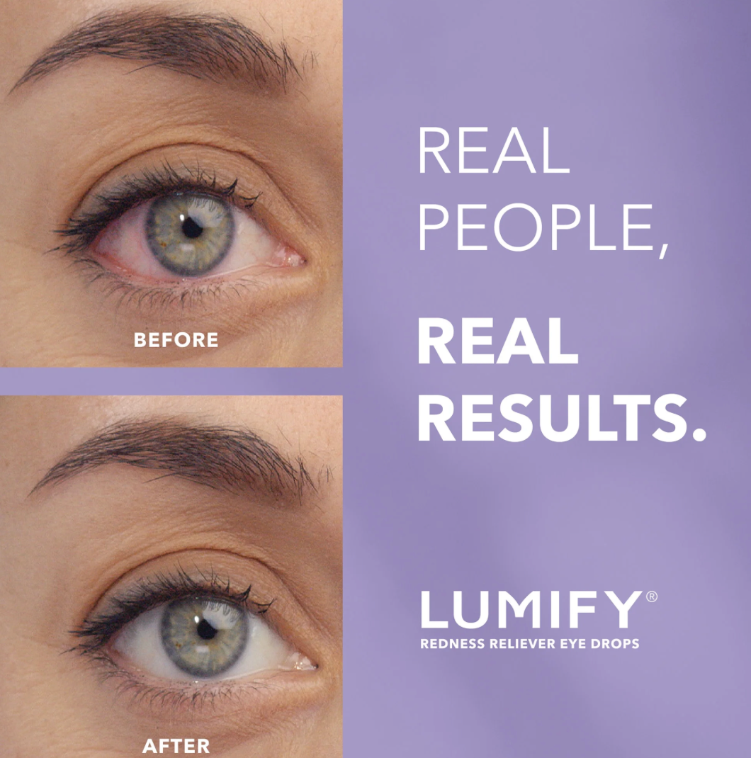 LUMIFY GOTAS 2.5ML