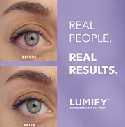 LUMIFY GOTAS 2.5ML