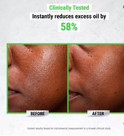 KIEHLS ULTRA PURE HIGH-POTENCY SERUM 5.0% NIACINAMIDE