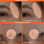 Cargar imagen en el visor de la galería, INNISFREE GREEN TEA VITAMIN C+ENZYME